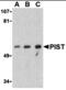 Golgi Associated PDZ And Coiled-Coil Motif Containing antibody, MBS150706, MyBioSource, Western Blot image 