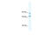 DEAD-Box Helicase 42 antibody, 28-490, ProSci, Western Blot image 