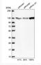 Poly(ADP-Ribose) Polymerase 1 antibody, NBP2-13732, Novus Biologicals, Western Blot image 