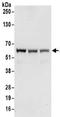 Zinc Finger Protein 622 antibody, NBP2-32103, Novus Biologicals, Western Blot image 