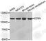 Striatin antibody, A3333, ABclonal Technology, Western Blot image 