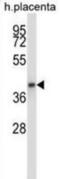 G Protein Subunit Alpha Q antibody, abx027855, Abbexa, Western Blot image 