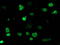 Myocyte Enhancer Factor 2C antibody, TA502565, Origene, Immunofluorescence image 