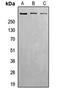 ATM Serine/Threonine Kinase antibody, orb215435, Biorbyt, Western Blot image 