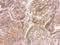 Indian Hedgehog Signaling Molecule antibody, GTX110355, GeneTex, Immunohistochemistry paraffin image 