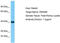 Olfactory Receptor Family 52 Subfamily B Member 2 antibody, TA332334, Origene, Western Blot image 