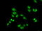 General Transcription Factor IIF Subunit 2 antibody, 15-024, ProSci, Immunofluorescence image 