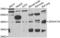 Zinc Finger DHHC-Type Containing 16 antibody, LS-C349048, Lifespan Biosciences, Western Blot image 
