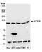 Vacuolar protein sorting-associated protein 18 homolog antibody, A305-542A, Bethyl Labs, Western Blot image 