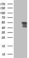 Peripherin antibody, LS-C790841, Lifespan Biosciences, Western Blot image 