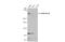 SET Domain Containing 2, Histone Lysine Methyltransferase antibody, GTX127905, GeneTex, Western Blot image 