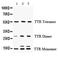 Transthyretin antibody, PA5-80196, Invitrogen Antibodies, Western Blot image 