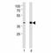 Activating Transcription Factor 2 antibody, F45125-0.4ML, NSJ Bioreagents, Western Blot image 