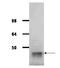 Aldolase, Fructose-Bisphosphate A antibody, GTX26190, GeneTex, Western Blot image 