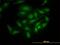 PDZ Binding Kinase antibody, H00055872-M11, Novus Biologicals, Immunofluorescence image 