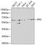 ETS Transcription Factor ERG antibody, GTX54015, GeneTex, Western Blot image 