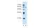 ALG11 Alpha-1,2-Mannosyltransferase antibody, 29-997, ProSci, Western Blot image 