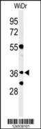NSE4 Homolog A, SMC5-SMC6 Complex Component antibody, 64-180, ProSci, Western Blot image 