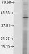 Hypoxia-inducible factor 1-alpha inhibitor antibody, LS-C227475, Lifespan Biosciences, Western Blot image 