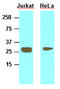 High Mobility Group Box 1 antibody, LS-C93743, Lifespan Biosciences, Western Blot image 