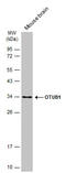 OTU Deubiquitinase, Ubiquitin Aldehyde Binding 1 antibody, GTX634648, GeneTex, Western Blot image 