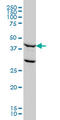 Flap Structure-Specific Endonuclease 1 antibody, LS-C197211, Lifespan Biosciences, Western Blot image 