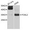 FOS Like 2, AP-1 Transcription Factor Subunit antibody, MBS126955, MyBioSource, Western Blot image 