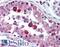 Hepatitis A Virus Cellular Receptor 1 antibody, LS-B2103, Lifespan Biosciences, Immunohistochemistry paraffin image 