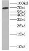 Integrator complex subunit 11 antibody, FNab04340, FineTest, Western Blot image 