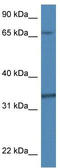 Tubulin Folding Cofactor B antibody, TA340003, Origene, Western Blot image 