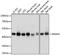 Armadillo Repeat Containing 6 antibody, A15931, ABclonal Technology, Western Blot image 