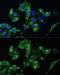 Prostate Transmembrane Protein, Androgen Induced 1 antibody, GTX64694, GeneTex, Immunofluorescence image 