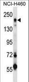 UPARAP antibody, LS-C164622, Lifespan Biosciences, Western Blot image 