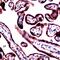 Ribonucleotide Reductase Catalytic Subunit M1 antibody, PA5-32574, Invitrogen Antibodies, Immunohistochemistry paraffin image 