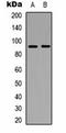 ATP Binding Cassette Subfamily B Member 5 antibody, orb323085, Biorbyt, Western Blot image 