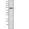 Minichromosome Maintenance 8 Homologous Recombination Repair Factor antibody, abx216760, Abbexa, Western Blot image 