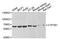 Cytochrome P450 Family 1 Subfamily B Member 1 antibody, MBS126962, MyBioSource, Western Blot image 
