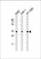 Transmembrane Protein 158 (Gene/Pseudogene) antibody, LS-C393048, Lifespan Biosciences, Western Blot image 