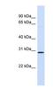 Fibroblast Growth Factor 14 antibody, NBP1-69006, Novus Biologicals, Western Blot image 