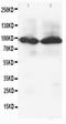 Activating Transcription Factor 6 antibody, PA1011, Boster Biological Technology, Western Blot image 