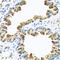Serpin Family A Member 10 antibody, LS-C346231, Lifespan Biosciences, Immunohistochemistry frozen image 