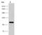 BBX High Mobility Group Box Domain Containing antibody, GTX03169, GeneTex, Western Blot image 