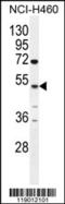 Carboxypeptidase A6 antibody, 55-785, ProSci, Western Blot image 