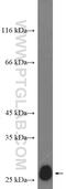 Cyclin Dependent Kinase Inhibitor 1B antibody, 26714-1-AP, Proteintech Group, Western Blot image 