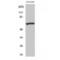 Myotubularin 1 antibody, LS-C384726, Lifespan Biosciences, Western Blot image 