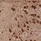 Lysyl-TRNA Synthetase antibody, NBP1-87706, Novus Biologicals, Immunohistochemistry frozen image 