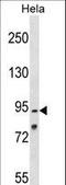 Oxysterol Binding Protein Like 1A antibody, LS-C163276, Lifespan Biosciences, Western Blot image 