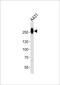 Myosin Heavy Chain 14 antibody, PA5-49331, Invitrogen Antibodies, Western Blot image 