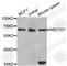 CGAS antibody, A8335, ABclonal Technology, Western Blot image 