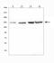 DNA Topoisomerase II Alpha antibody, A00953, Boster Biological Technology, Western Blot image 